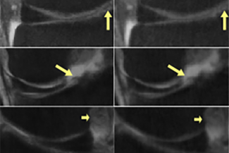 Medical Scan